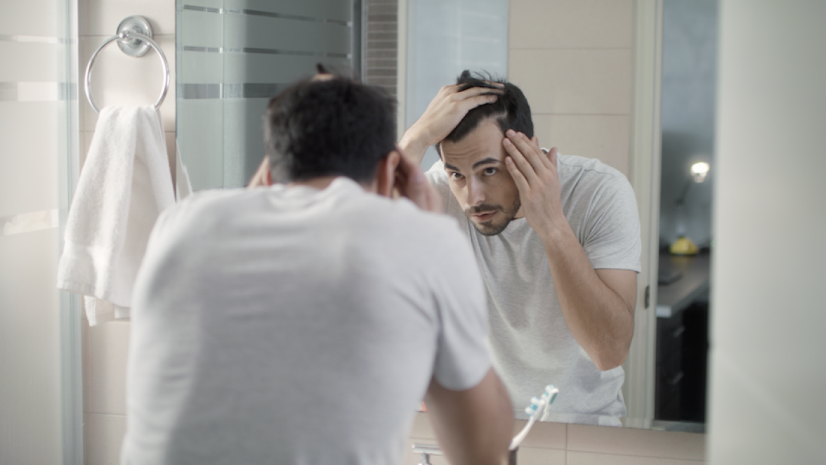 Tips and Treatments to Combat Hair Loss